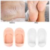 Beige Siliconen pad voor vijf tenen met perforatie teenbescherming, mini sokken-P-05-06-04-Foot care-Alles voor manicure