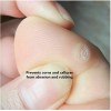 Beschermende pads-siliconen mokken. Schokabsorberende voering. Patch Ring #3-15 stuks-P-42-Foot care-Alles voor manicure