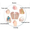 Korrektor Fünf-Finger-Trennzeichen aus medizinischem Silikon mit Fixierringen am Daumen und kleinen Finger-P-18-05-Foot care-Alles für die Maniküre