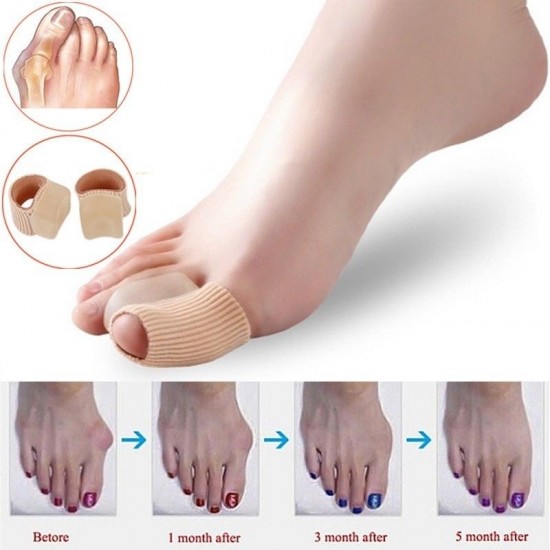 Septo interdigital, corrector para deformidade dos dedos, interdigital, separador de gel, baseado em tecido-P-20-5-Foot care-Tudo para manicure