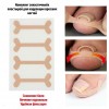 Kit de parche de corrección de uñas encarnadas 4pcs elástico transpirable Reparación corrección Fijador-3744-13-9-Foot care-Todo para la manicura
