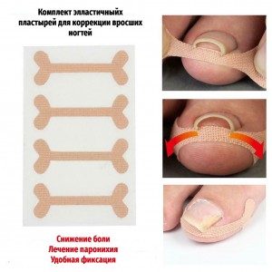 Set of patches for the correction of ingrown nails, 4 PCs, Elastic, breathable, Restoration, Correction, Retainer