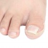 Set pleisters voor correctie van ingegroeide nagels, 4 stuks, elastisch, ademend, restauratie, correctie, Fixator-3744-13-9-Foot care-Alles voor manicure