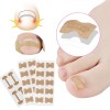 Self-adhesive patch with a plate for correction of ingrown nails, sticker, 10 PCs, nail retainer, 3744, Materials for manicure and pedicure,  Health and beauty. All for beauty salons,All for a manicure ,Subology, buy with worldwide shipping