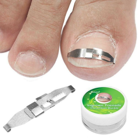 Hebilla de acero inoxidable reutilizable # 44 para corrección, corrección, fijación de uñas encarnadas y torcidas-952744925-Foot care-Todo para la manicura