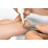 Onyclip kit de tratamento de unhas encravadas Onyclip-Spangen-Set-33041-Baehr-Podologia