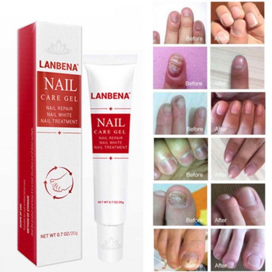 LANBENA NAIL CARE GELNAIL REPAIR REPAIR TREATMENT, P-15-2, Subology,  All for a manicure,Subology ,  buy with worldwide shipping