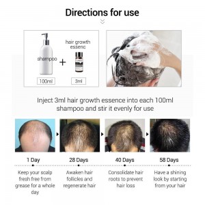 Aceite de efecto para el crecimiento rápido y potente del cabello Lanbena Hair Growth Essential Oil