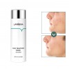 Toner para a pele Facial, Tratamento Da Acne Lanbena-952732794-Lanbena-Beleza e saúde. Tudo para salões de beleza