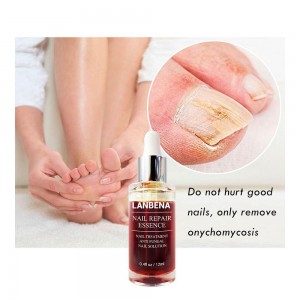 Lanbena serum for fungal nail Treatment removes onychomycosis, hand and foot care