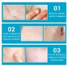 Lanbena Pimple patch 25pcs tratamento da acne pimple patch uso diário adesivos invisíveis Cuidados com a pele-952732863-Lanbena-Beleza e saúde. Tudo para salões de beleza