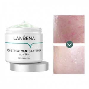 LANBENA clay acne treatment mask for deep cleansing, pore cleansing, reducing black blade and acne to restore clear skin
