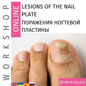 The course of nail plate damage: causes, types, prevention  